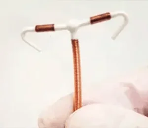 Complications During Removal of the Paragard IUD